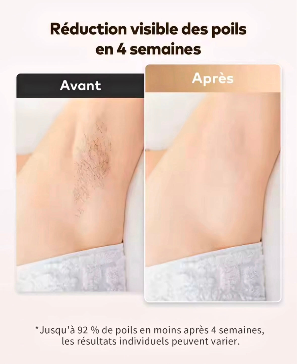 Epilateur IPL SKYNLITE - Lumière pulsée